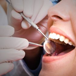 Why You Should Invest In Dental Implants Vs. Dentures