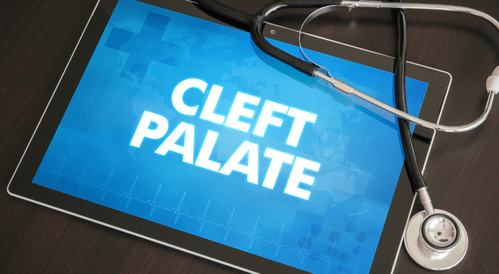 New Guidelines For Cleft Palate And Oral Health Released