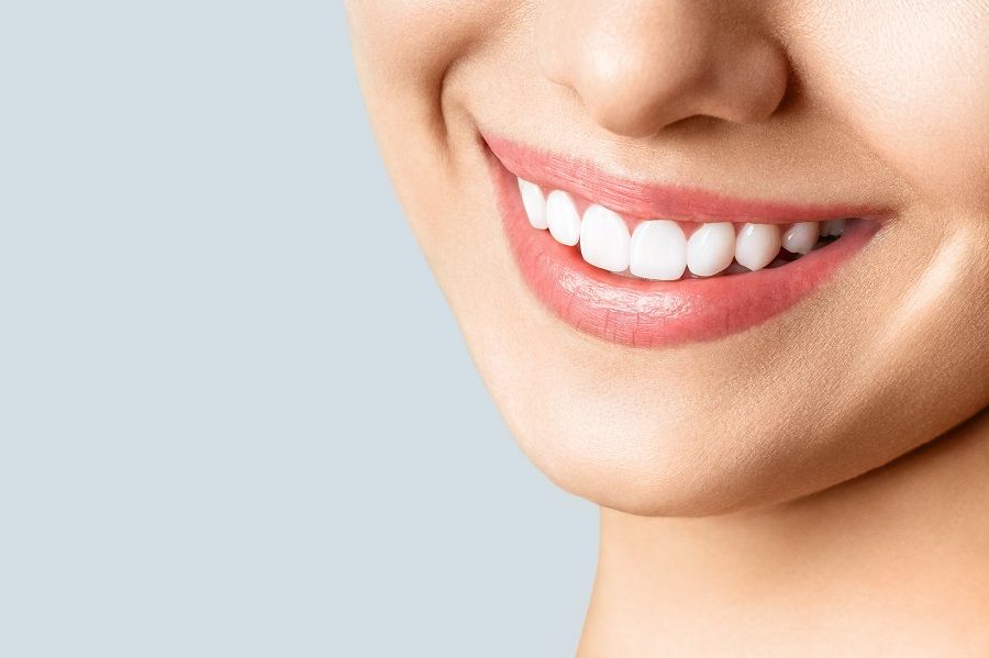 How To Keep Your Teeth White After A Professional Whitening Treatment