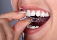 This App Could Change Invisalign®
