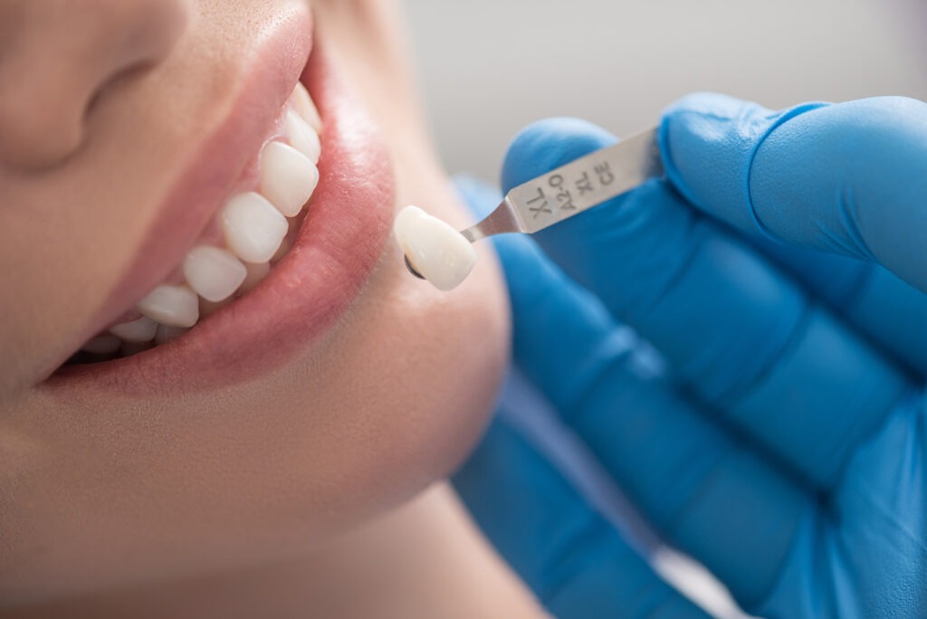 Artificial Intelligence Could Someday Make Dental Crowns